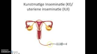 SOAs geboorteregeling en IVF HAVO4 [upl. by Hasseman]