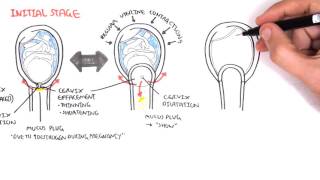 Obstetrics  Stage I of Labour [upl. by Nuj665]