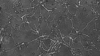 Neurite network formation [upl. by Tavey]