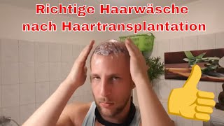 Haartransplantation Haare waschen nach OP [upl. by Ardnazxela]