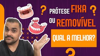 Prótese Fixa ou Removível Qual a melhor [upl. by Straus30]