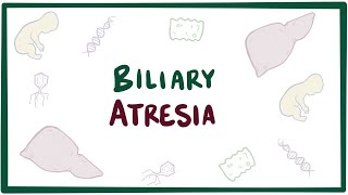 Biliary atresia  causes symptoms diagnosis treatment amp pathology [upl. by Nifares570]