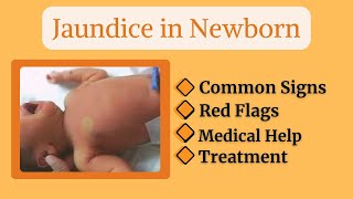 “Why Do Newborns Turn Yellow Understanding Jaundice in Babies” baby newborn newparentsguide [upl. by Kee931]