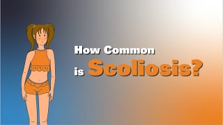 Insight into Adolescent Idiopathic Scoliosis [upl. by Nivag]