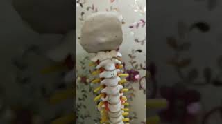 Cervical pain treatment  disk bulge  MCG Technique by Dr Veeresh Kumar [upl. by Ynnam]