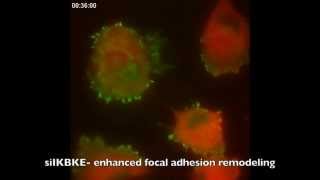 Dynamic focal adhesions [upl. by Une]