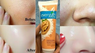 How to Use Face Scrubs  Everyuth ScrubHow to Apply Face Scrub at Home Hindi [upl. by Anneuq959]