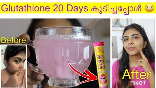 😜നടിമാരുടെ രഹസ്യം ഞാനും ട്രൈ ചെയ്യ്തു  20 Days Glutathione amp Vitamin C ഇതുപോലെ കുടിച്ചപ്പോൾ [upl. by Des]