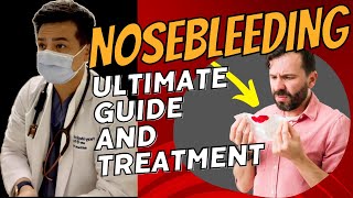 The Ultimate Guide to Nosebleeds Causes Treatments and Prevention You Need to Know [upl. by Karee]