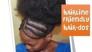 45 Hairline Friendly Hairstyles  Braided Headband [upl. by Vahe]