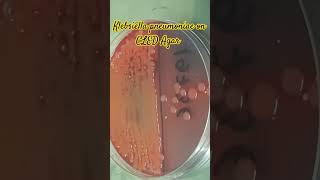 Klebsiella pneumoniae colony morphology on CLED agar of Urine Culture [upl. by Nnaynaffit]