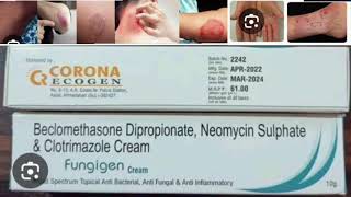 Fungigen Cream Beclomethasone Dipropionate Neomycin Sulphate amp Clotrimazole Cream [upl. by Nosecyrb]