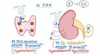 Familial Hypocalcuric Hypercalcemia FHH  Endocrinology and Nephrology [upl. by Esorrebma]