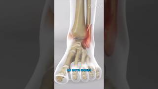 Ankle Fracture Surgery 3D Animation [upl. by Emanuele]