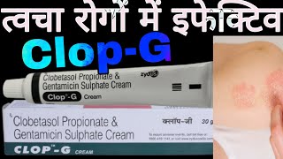 CLOPG Cream Uses in Hindi  Clobetasol Propionate amp Gentamicin Sulphate Cream [upl. by Eibbed]