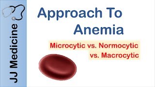 Anemia  Microcytic vs Normocytic vs Macrocytic [upl. by Yann655]