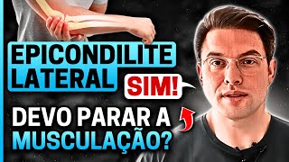 Quem tem EPICONDILITE LATERAL pode fazer MUSCULAÇÃO  Muzy Explica [upl. by See]