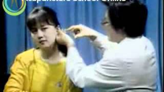 Acupuncture Video Course Lesson 22  Auricular Diagnosis And Treatment [upl. by Abdella]