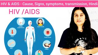 HIVAIDS Myths amp Facts in Hindi  Dr Shuchin Bajaj [upl. by Udell]