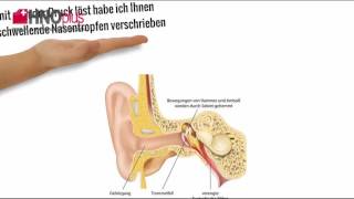 Behandlung des Ohrendruck [upl. by Lynd]