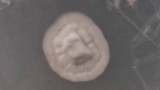 Mycelium agar timelapse [upl. by Vinson]