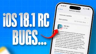 iOS 181 RC Features Bugs amp Call Recording amp New Hearing Aid Features [upl. by Eniamart53]