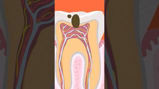 Root Canal Treatmentrct [upl. by Salome]