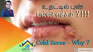 உதட்டில் புண்  பல்லி எச்சம்  Cold Sores  Why   தமிழ் [upl. by Gerty]