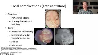 Lecture Innovations and Advances in Retinoblastoma Management [upl. by Housum]