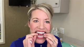 Teeth Whitening Instructions [upl. by Sidra]