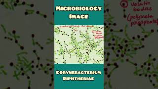 Corynaebacterium diphtheriae image  Microbiology Medicine  shorts [upl. by Aneerhs706]