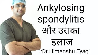 Ankylosing spondylitis और उसका इलाजTreatment [upl. by Lathrope]