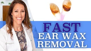 Clogged Ears  How to Remove Ear Wax At Home With Hydrogen Peroxide [upl. by Anelagna]