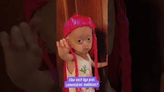 25 Elis e Eloa lindas progeria irmagemeas eliseeloa fyp eloa elis happyfamily love [upl. by Fax]