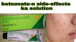 betnovate n cream ke sideeffects ka solution  how to use betnovate n cream  hindi [upl. by Eisteb511]