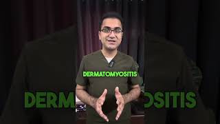 Prodoc Tip 47 Dermatomyositis and Importance of Malignancy Screening USMLE NEETPG [upl. by Irby595]