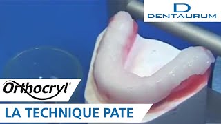 Orthocryl®  gouttière occlusale réalisée selon la technique pâte appareil dentaire [upl. by Ayotnahs135]