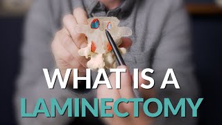 What is a Laminectomy  Spine Surgery Basics [upl. by Tayler]