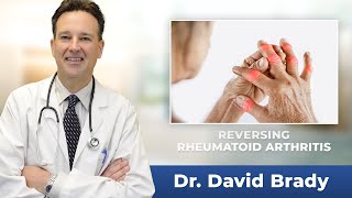 Reversing Rheumatoid Arthritis with Dr David Brady Reversing Arthritis symptoms [upl. by Yanal589]