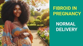 Fibroid in pregnancy  Normal delivery or CS  My pregnancy Journey [upl. by Llereg295]