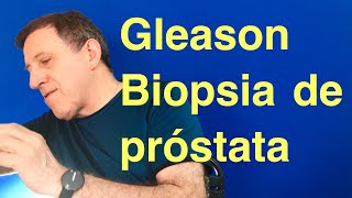 Que significa Gleason en la Biopsia de próstata [upl. by Rosen]