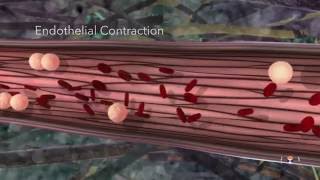 Acute Inflammation Educational 3D Animation [upl. by Hube]