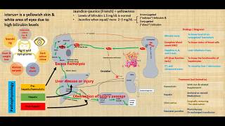 Jaundice causes diagnosis treatment of jaundice prehepatic hepatic post hepatic jaundice [upl. by Htidirem]