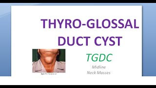 ENT ThyroGlossal Duct Cyst TGDC Neck swelling bump lump swollen midline middle center Sistrunk [upl. by Kyrstin540]