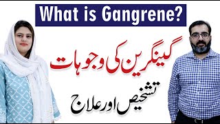 What is Gangrene Causes Diagnosis and its Treatment  Dr Usman Jamil with Dr Arooj Azam [upl. by Oilerua]