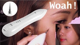 Warts and Mole Remover Pen EFFECTIVE or NOT [upl. by Marley]