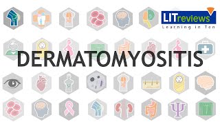 Dermatomyositis [upl. by Nerek75]