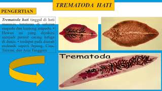 Trematoda Hati  Karlina [upl. by Noxaj398]