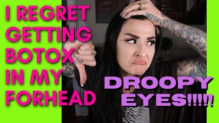 I REGET GETTING BOTOXDYSPORT in my forehead What you need to know before getting injections [upl. by Hanah]