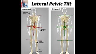 LATERAL PELVIC TILT  HIP COMPLEX BIOMECHANICS [upl. by Ellohcin]